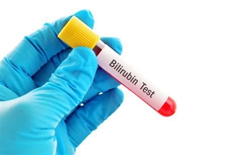 Bilirubin Test: Understanding High vs. Low Levels & Its Causes.